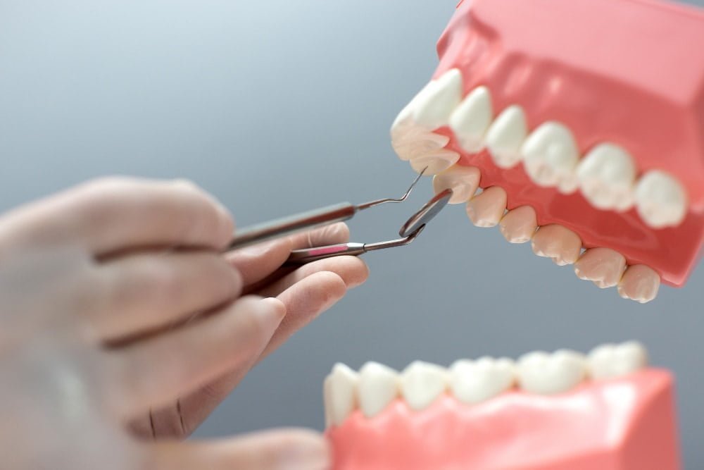 prosthetic-dental- treatment-in-turkey